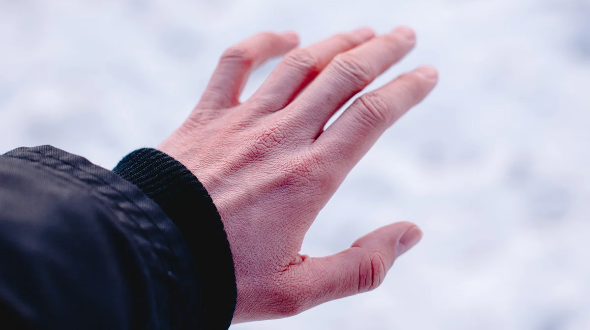 Featured image for “7 frostbite symptoms you should never ignore”